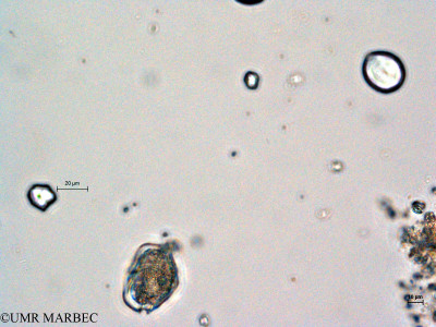 phyto/Thau_Lagoon/THAU_station1/GELAMED 2010/Protoperidinium denticulatum (2)(copy)_thumb.jpg